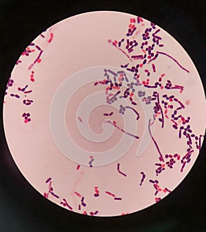 yeast cells and hyphae in gram stain fine with microscope.