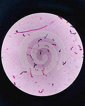 yeast cells and hyphae in gram stain fine with microscope.