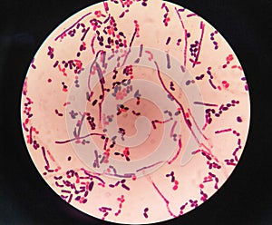 yeast cells and hyphae in gram stain fine with microscope.