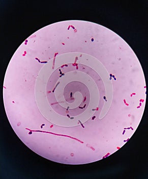 yeast cells and hyphae in gram stain fine with microscope.