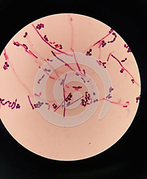 yeast cells and hyphae in gram stain fine with microscope.