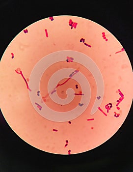 yeast cells and hyphae in gram stain fine with microscope.