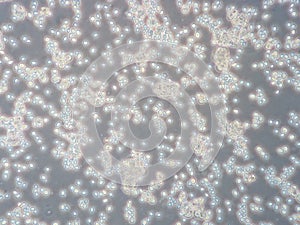 Yeast cells