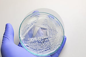 Yeast in petri dish for education in laboratories.