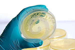 Yellow bacteria on a petri dish in the hand of a scientist on the laboratory background