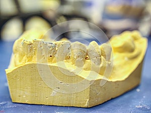 Yellow gypsum model in dental laboratory