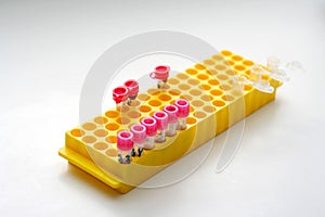 Yellow holder of test tubes for biological liquids