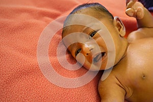 A yellow skin colored neonatal jaundice baby crying in pain