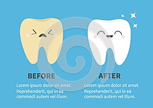 Yellow white tooth icon. Shining star. Healthy smiling Crying bad ill teeth set. Before after Infographic Template. Cute cartoon