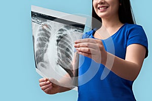 Young adult asian woman holding x-ray picture and smiling wide