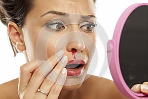 Woman with nose bleeding