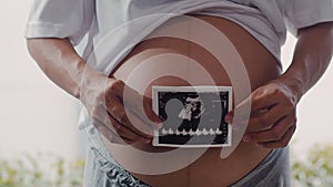 Young Asian Pregnant women show and looking ultrasound photo baby in belly. Mom feeling happy smiling peaceful while take care