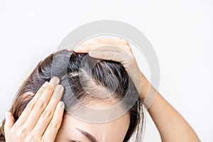 Young asian women worried about hair loss problems