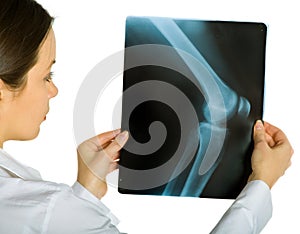 Young attractive female doctor looking x-ray