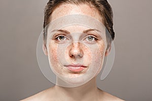 Young beautiful freckles woman face portrait with healthy skin