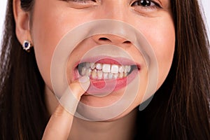 Young beautiful woman touches her teeth with her finger on the lower jaw, showing a problem with teeth or gums