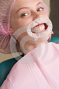 Young blond female opening her mouth while unidentifiable dentist in latex gloves check condition of her teeth. Happy