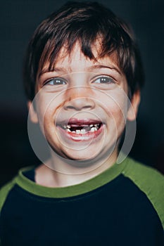 Young boy grinning with missing teeth