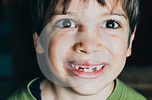 Young boy with missing teeth smiling