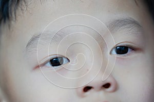 Young boy`s eyes and nose,closed up view