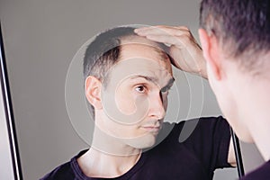 Young caucasian man looking at mirror worried about balding.