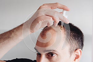 Young caucasian man looking at mirror worried about balding.