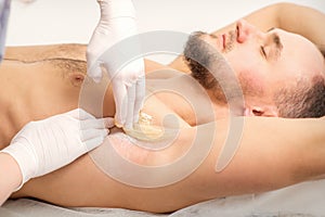 Young caucasian man receiving hair removal from his armpit in a beauty salon, depilation men underarm.