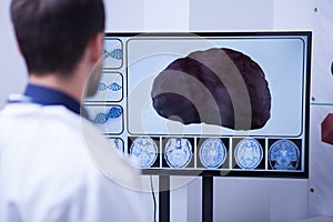 Young doctor checking a brain after nerve surgery