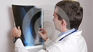 A young doctor examines the results of a patient`s X-ray on the wall. Analyzes of the thorax and ribs.