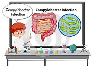 Young doctor explaining Campylobacter infection photo