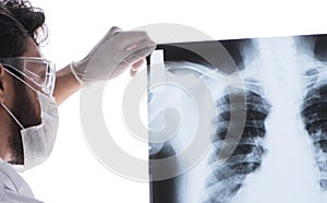 Young doctor looking at x-ray images isolated on white