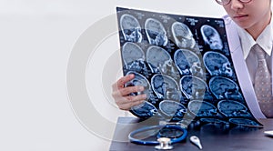 Young female doctor holding MRI or CT scan picture