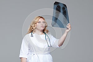 Young female doctor looking at the x-ray picture of lungs.