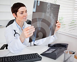 Young female doctor looking at X-ray