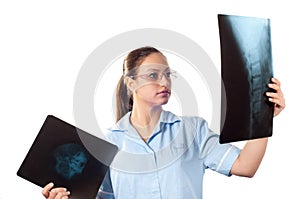 Young female doctor looking at x-ray picture