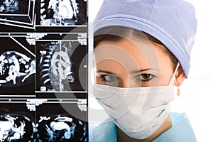 Young female doctor with tomogram