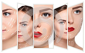 The young female face. Antiaging and thread lifting concept