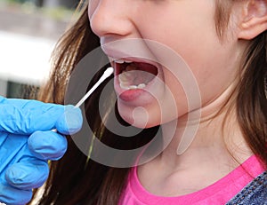 Young girl with open mouth during diagnosis for coronavirus research with an oropharyngeal swab