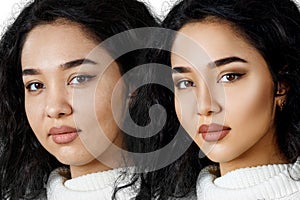 Young girl with problem skin before and after retouch.