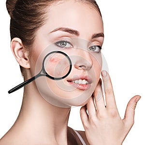 Young girl shows acne with magnifying glass.