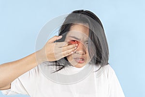 Young girl suffering from eyes pain and feeling something in eye, posing on blue wall. Cause of pain include contact lens problem
