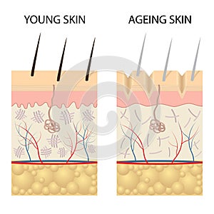 Young healthy skin and older skin comparison.