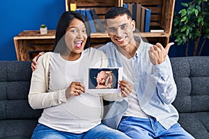 Young hispanic couple expecting a baby sitting on the sofa showing baby ultrasound pointing thumb up to the side smiling happy