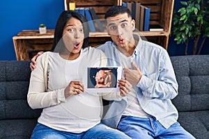 Young hispanic couple expecting a baby sitting on the sofa showing baby ultrasound scared and amazed with open mouth for surprise,