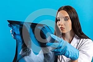 A young lady doctor is holding an x-ray of her lungs and is checking for ammonals