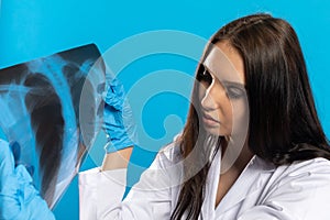 A young lady doctor is holding an x-ray of her lungs and is checking for ammonals