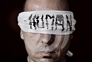 Young man with a blindfold in his eyes