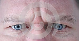 Young man with blue eyes frown closeup