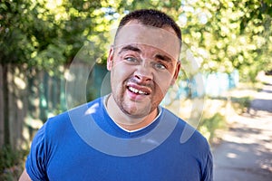 Young man in a blue T-shirt with a chipped tooth