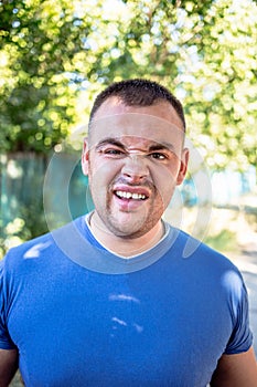 Young man with a chipped tooth